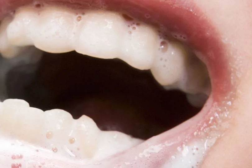 /img/34185-smiling-with-white-teeth.webp