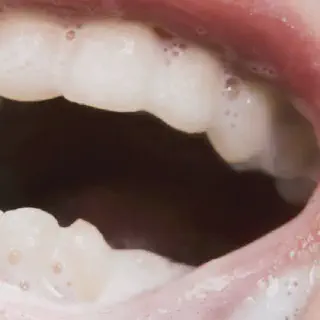 /img/34185-smiling-with-white-teeth.webp
