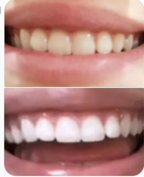 34199 mesa az dentist consultation