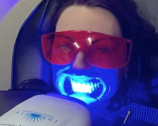 34199 teeth whitening mesa az before after