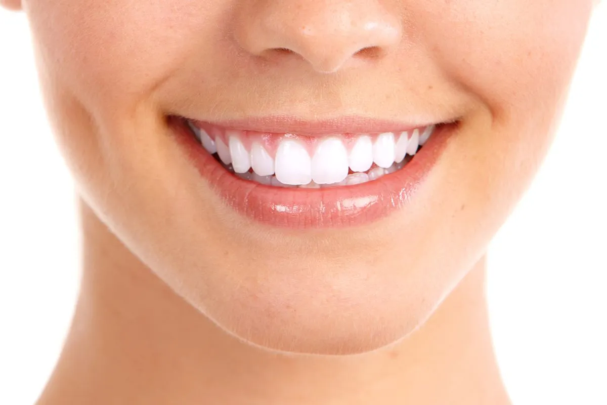 34218 teeth whitening before after
