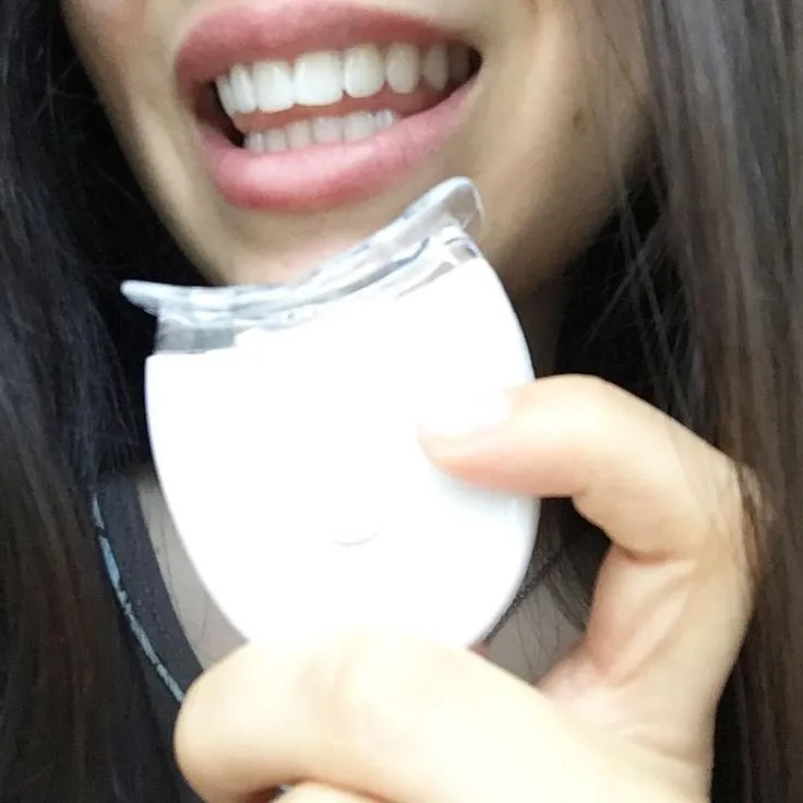 /img/34218-teeth-whitening-sensitivity.webp