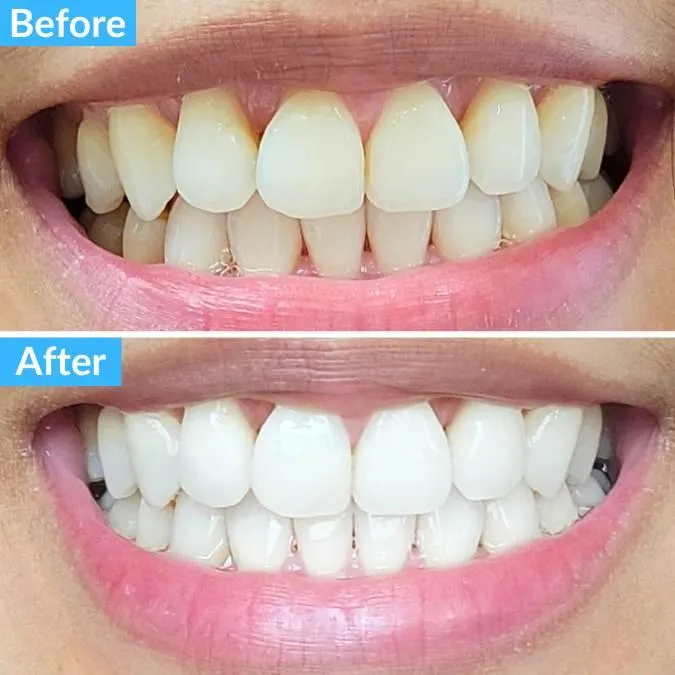 34223 sensitive teeth care