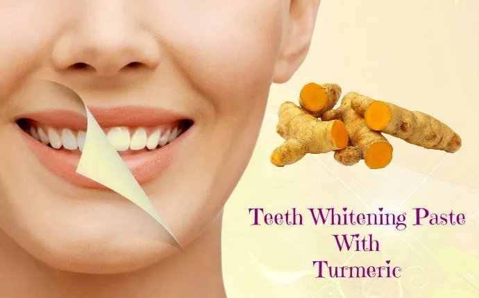 34267 stained teeth