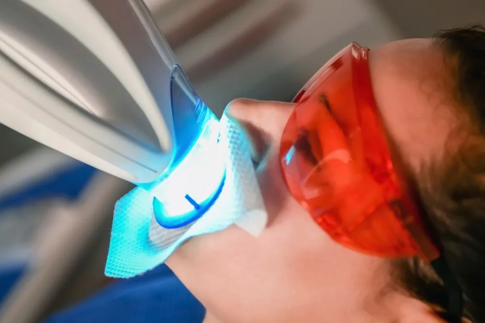 34270 geha dental teeth whitening benefits