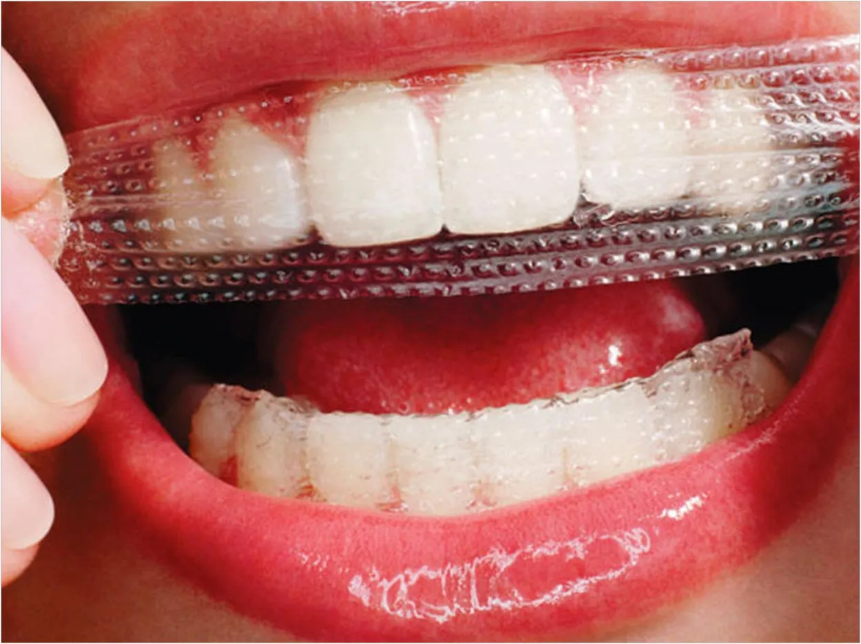 34271 improper whitening