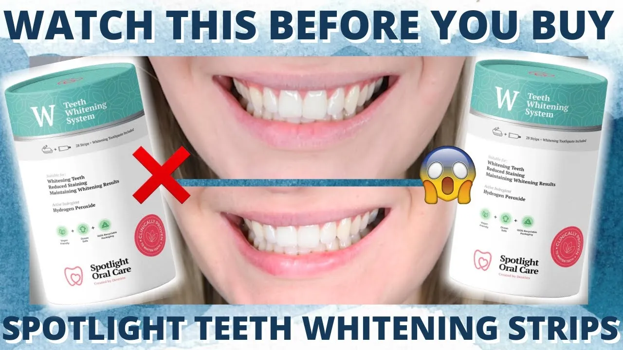34271 tooth cracks