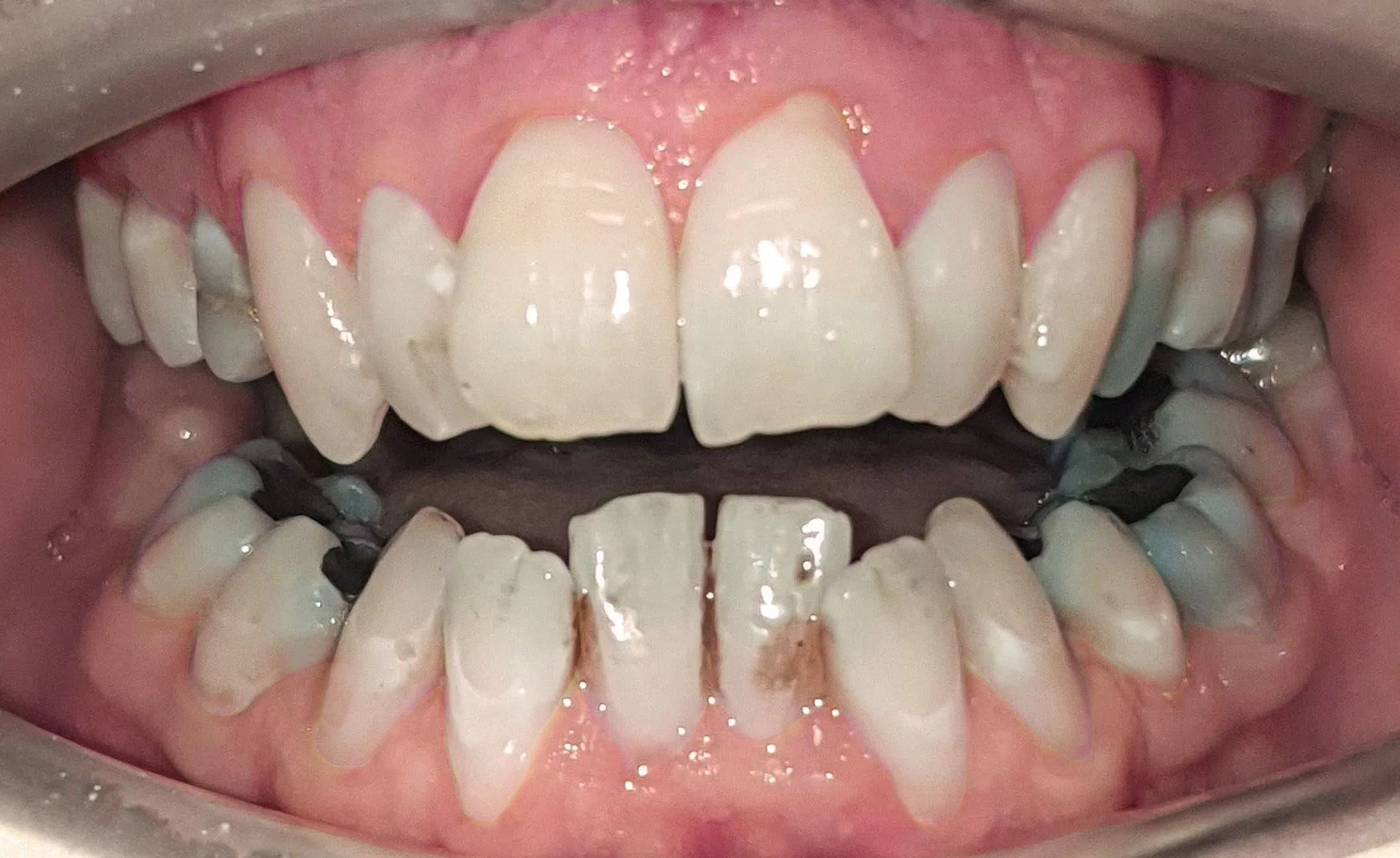 34273 avoid staining foods drinks