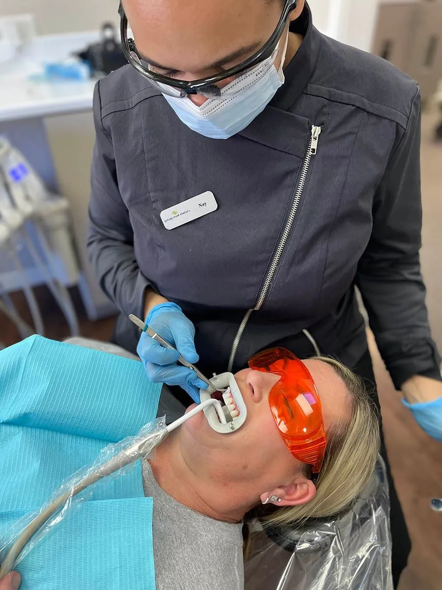 34278 take home teeth whitening