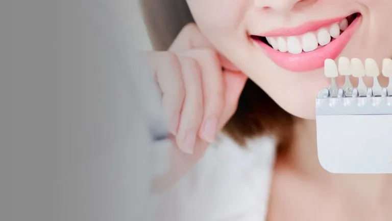 34307 iwhite teeth whitening singapore 3