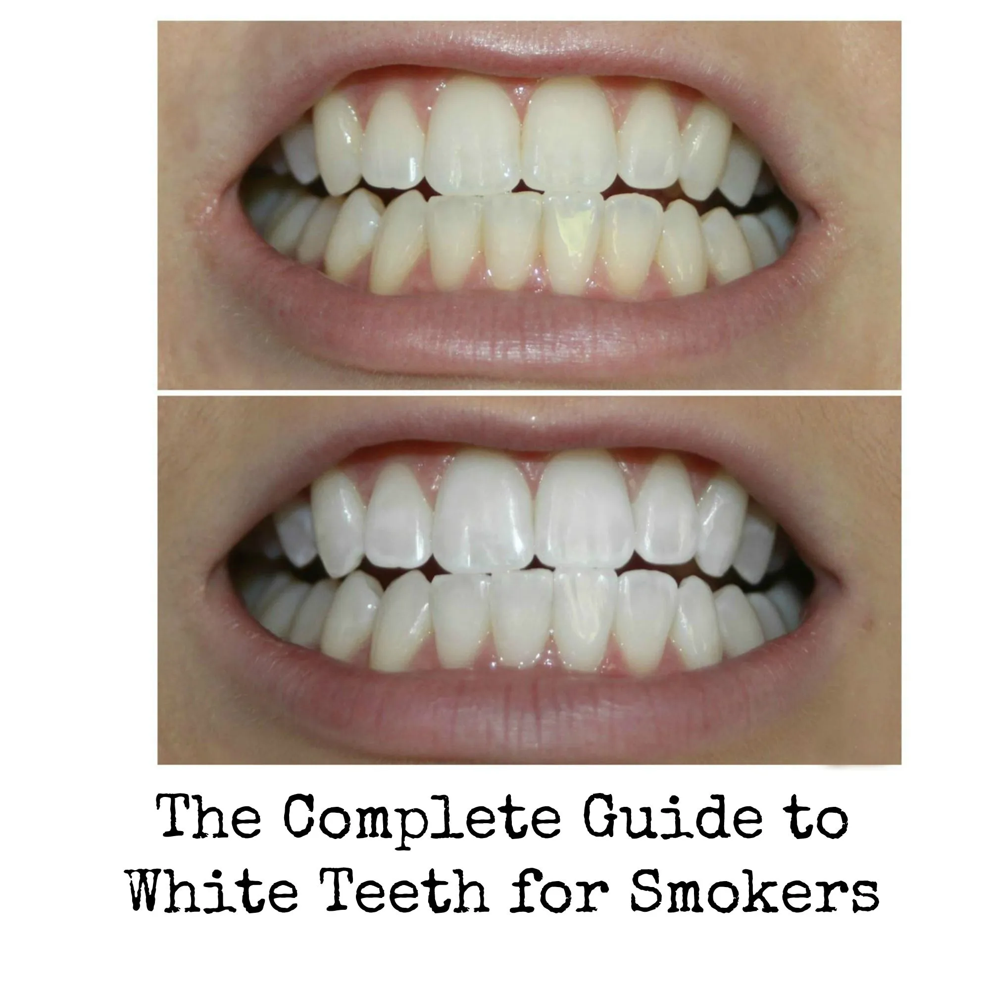 34310 quit smoking
