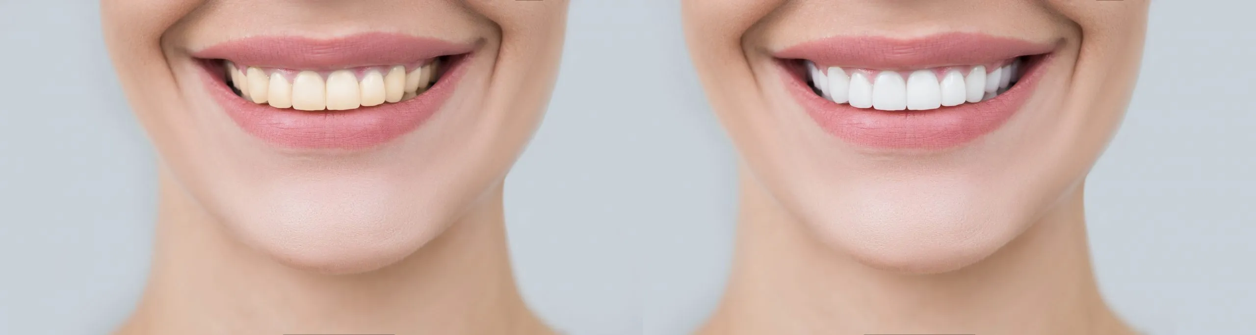 /img/34341-smile-maintenance.webp