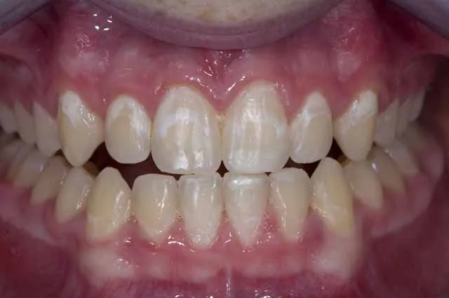 /img/34344-dentist-checking-teeth-8.webp