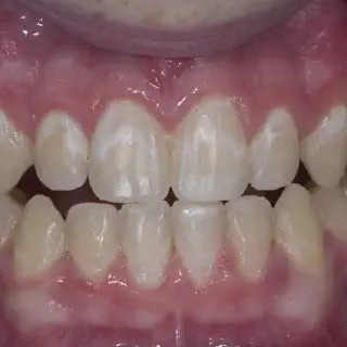 /img/34344-dentist-checking-teeth-8.webp