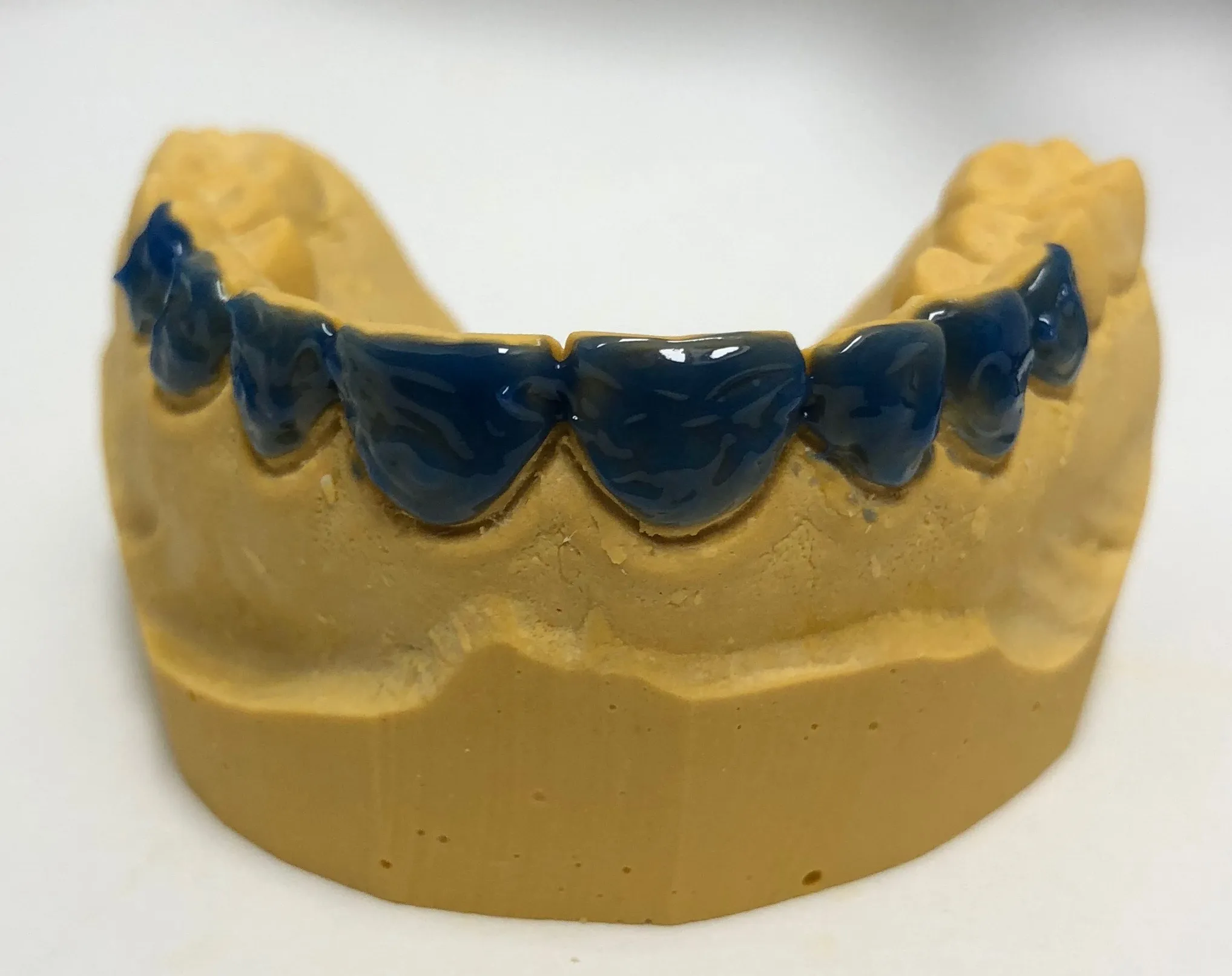 34362 oral hygiene
