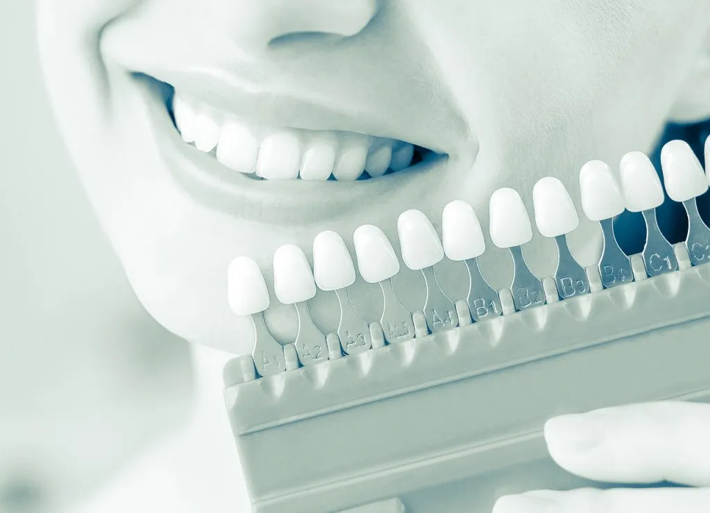 34376 professional tooth whitening