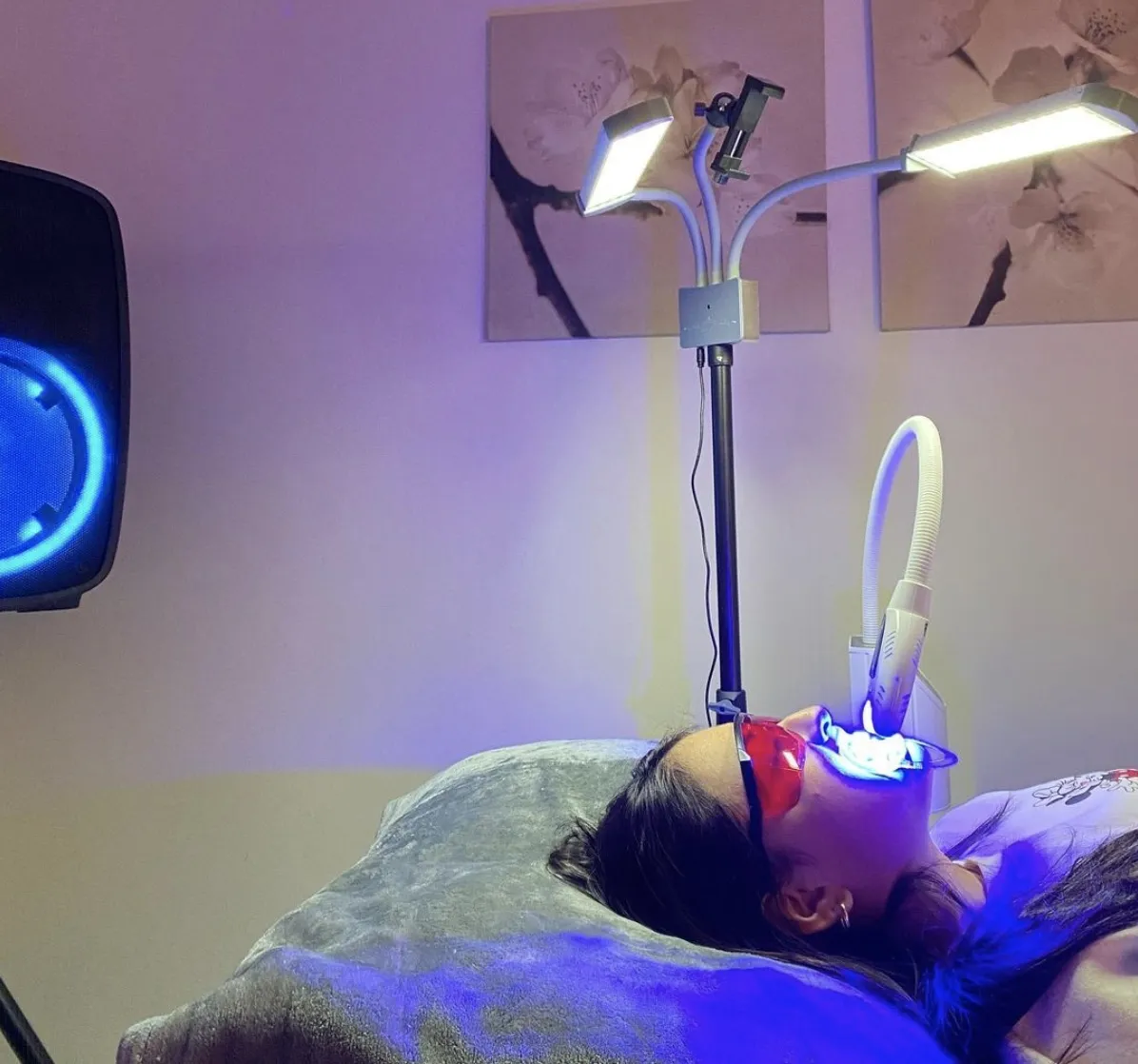 34376 teeth whitening toronto 1