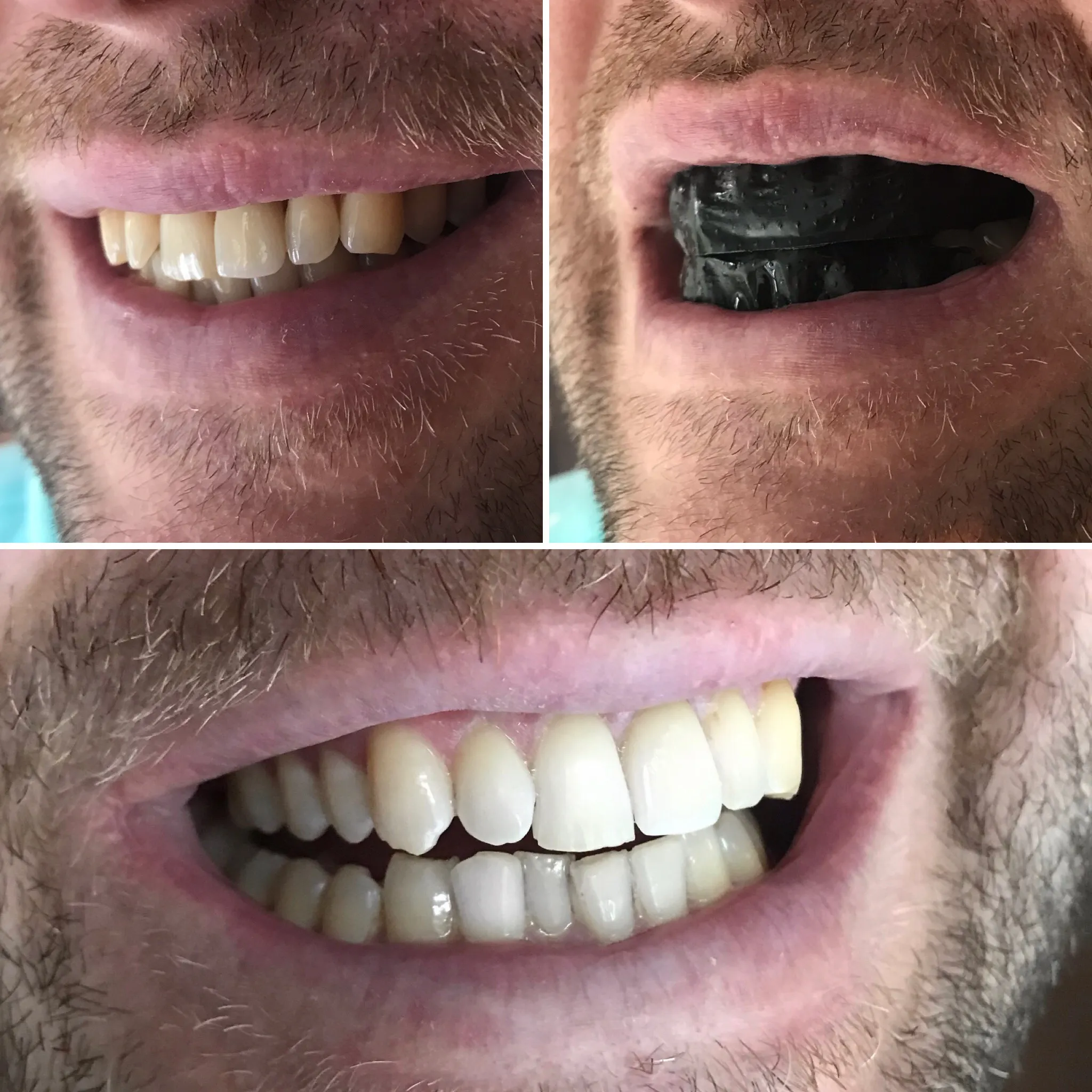 34426 healthy diet teeth
