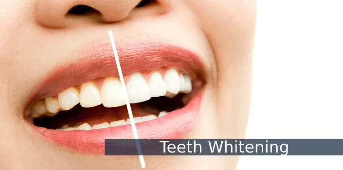 /img/34438-teeth-whitening-monaghan-dental-checkup.webp