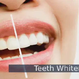 /img/34438-teeth-whitening-monaghan-dental-checkup.webp