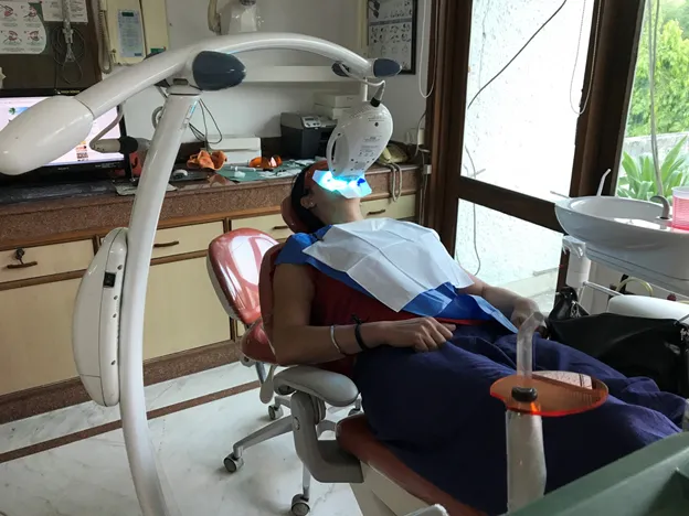 34441 at home teeth whitening