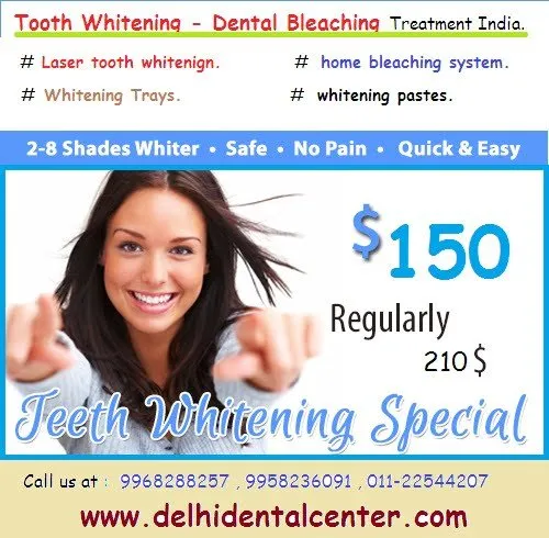 34441 teeth whitening comparison