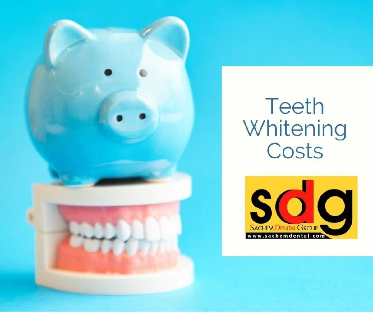 34444 take home teeth whitening kits