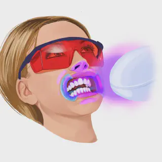 /img/34444-teeth-whitening-maintenance.webp