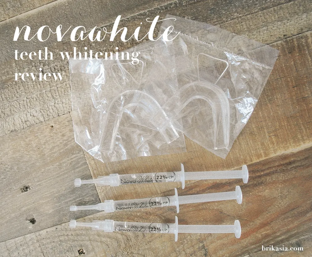 34469 teeth whitening results