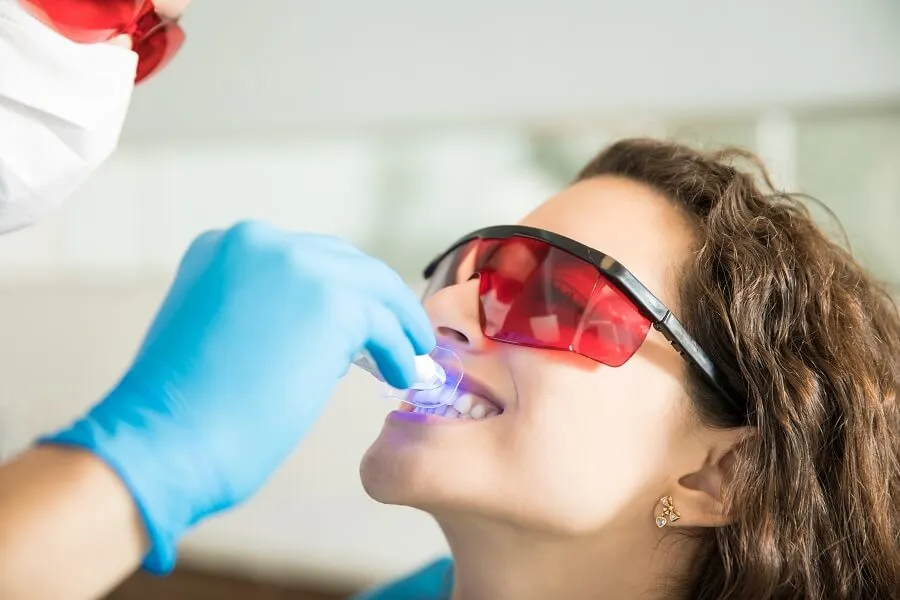 34471 at home teeth whitening
