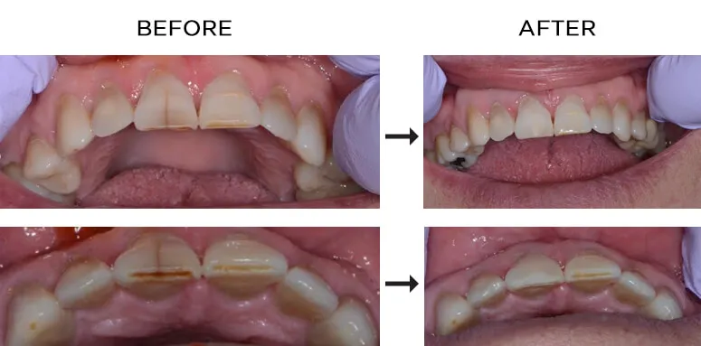 34474 teeth whitening smile