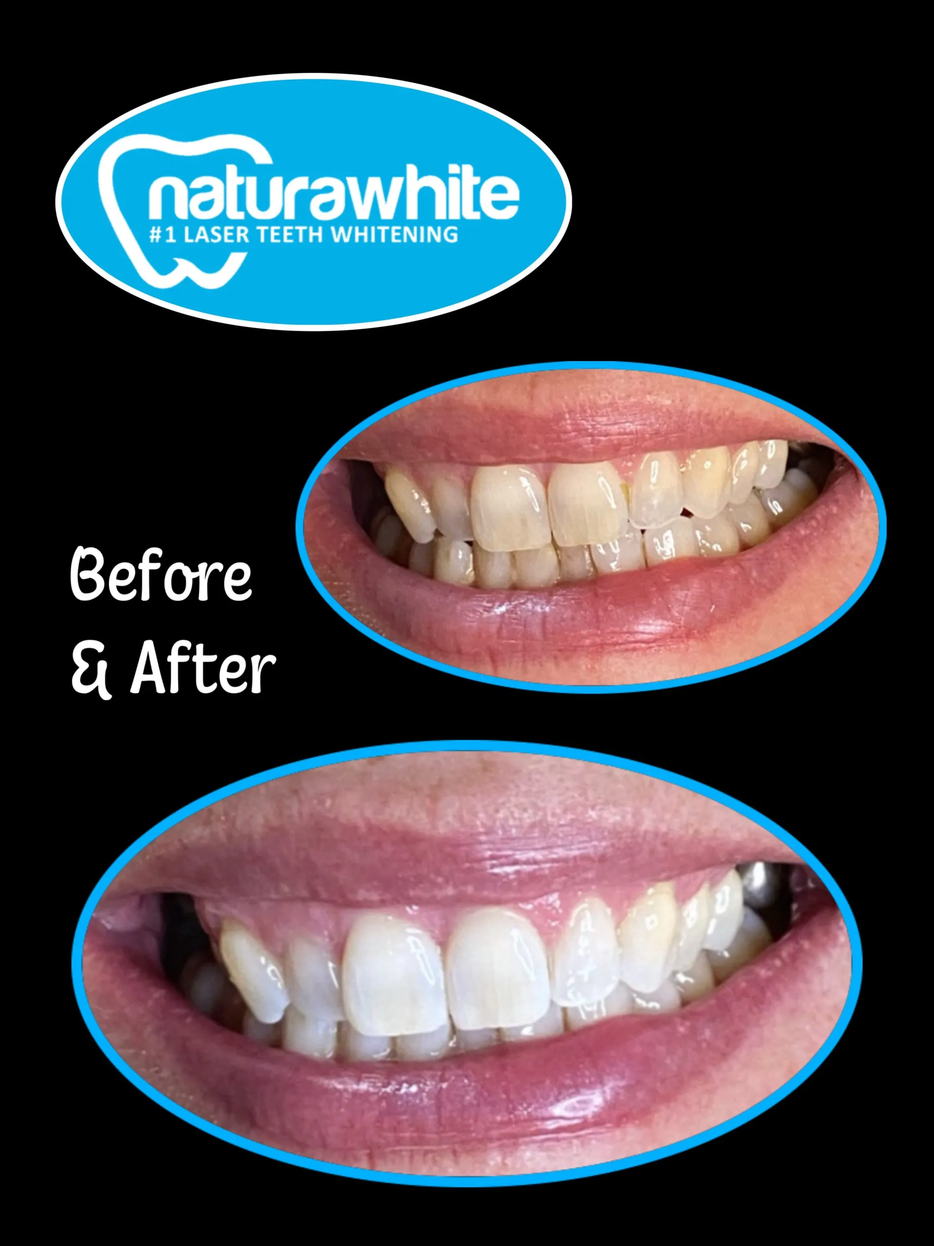 /img/34490-teeth-whitening-confidence.webp