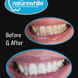 /img/34490-teeth-whitening-confidence.webp