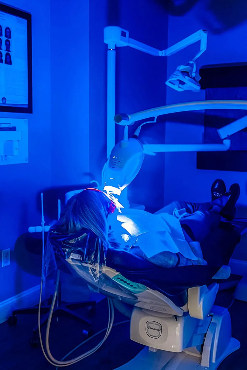 34490 teeth whitening treatment types
