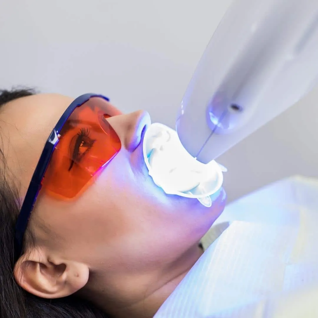 34499 cedar rapids teeth whitening 1