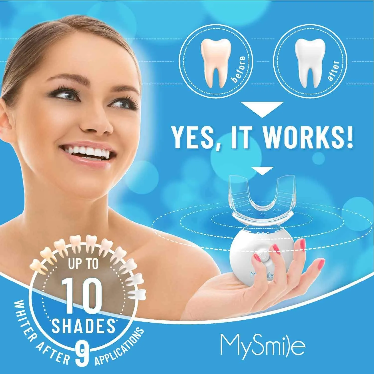 34509 mysmile kit overview