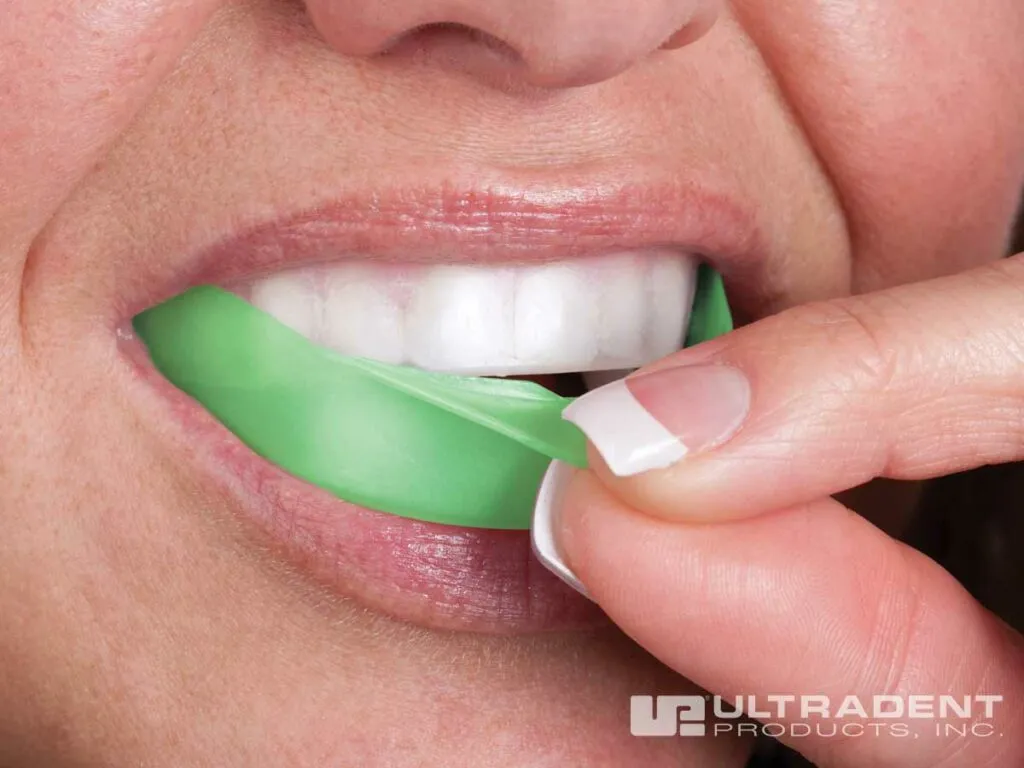 34519 at home teeth whitening kits hilliard