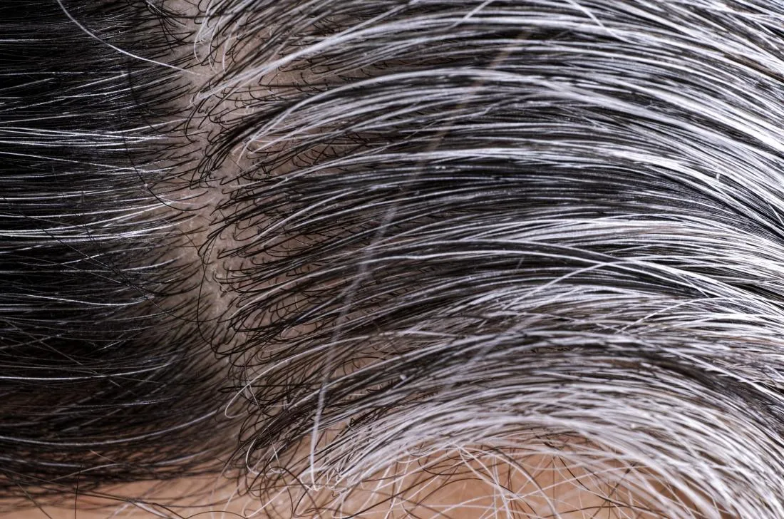 34524 hair healthy diet