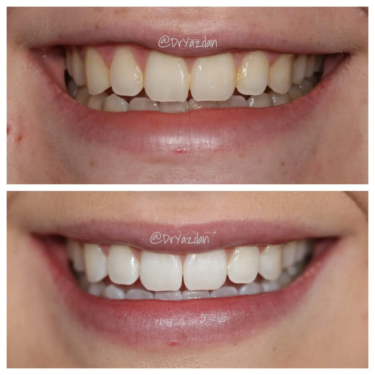 34527 bright smile healthy teeth