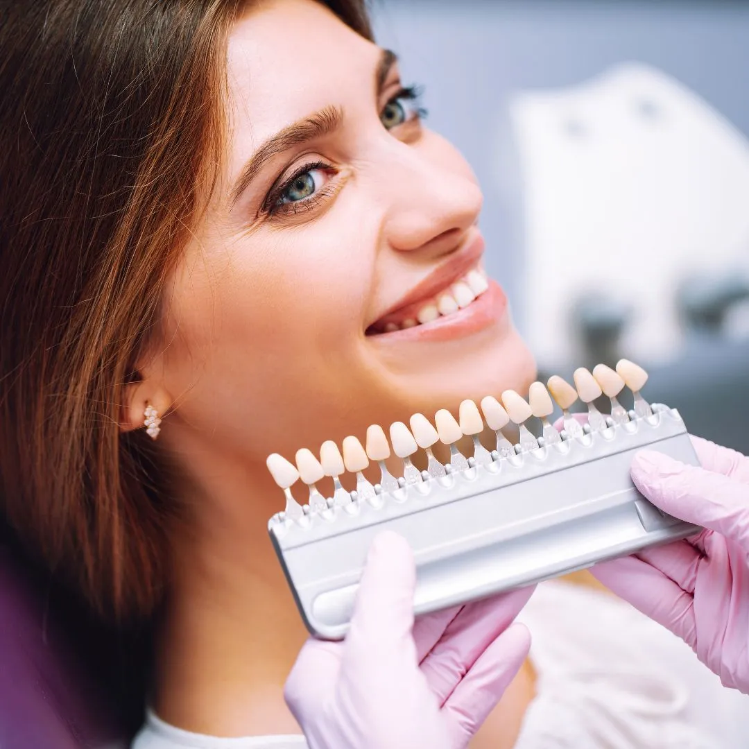 34527 teeth whitening before after