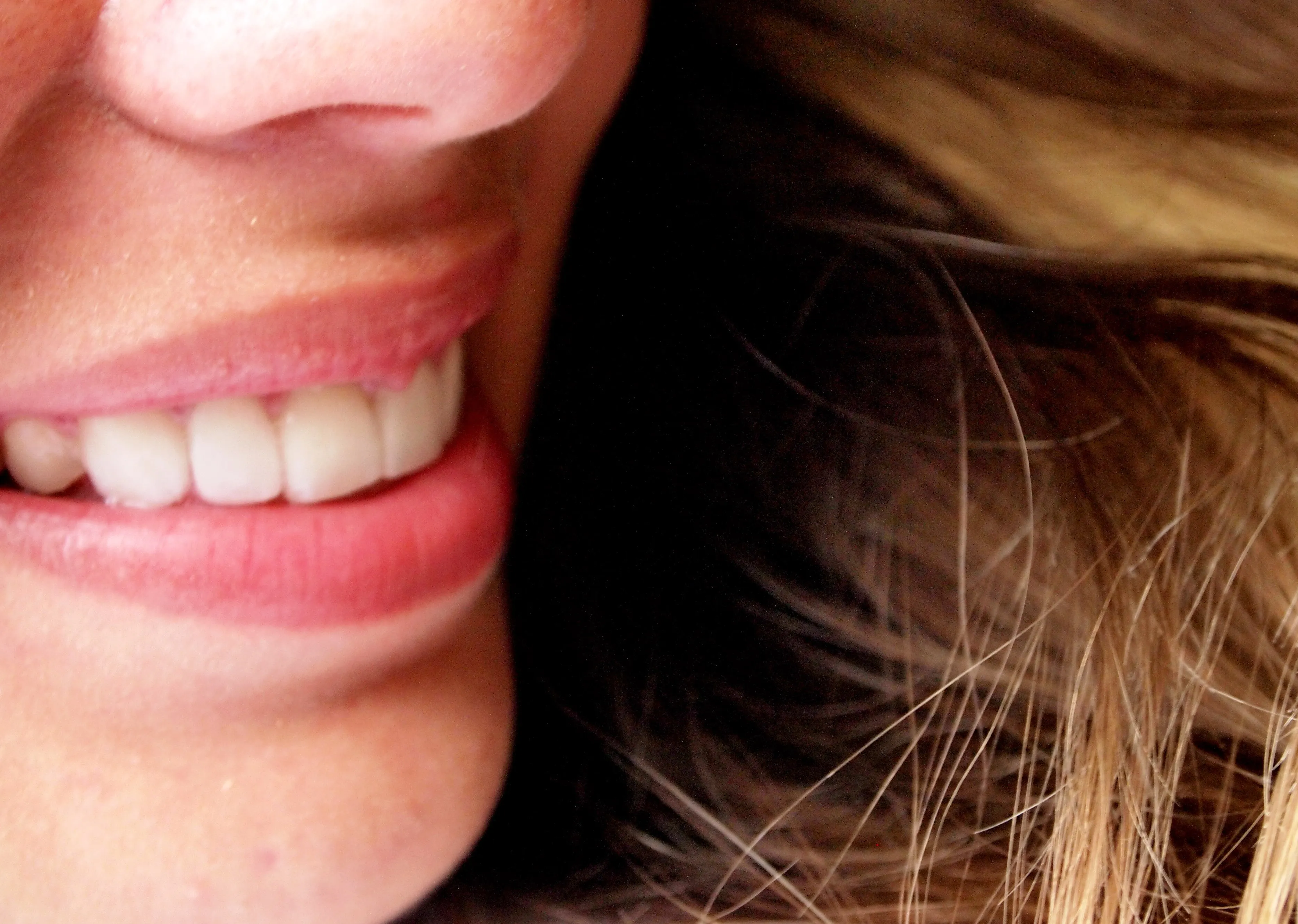 34528 gum irritation teeth whitening