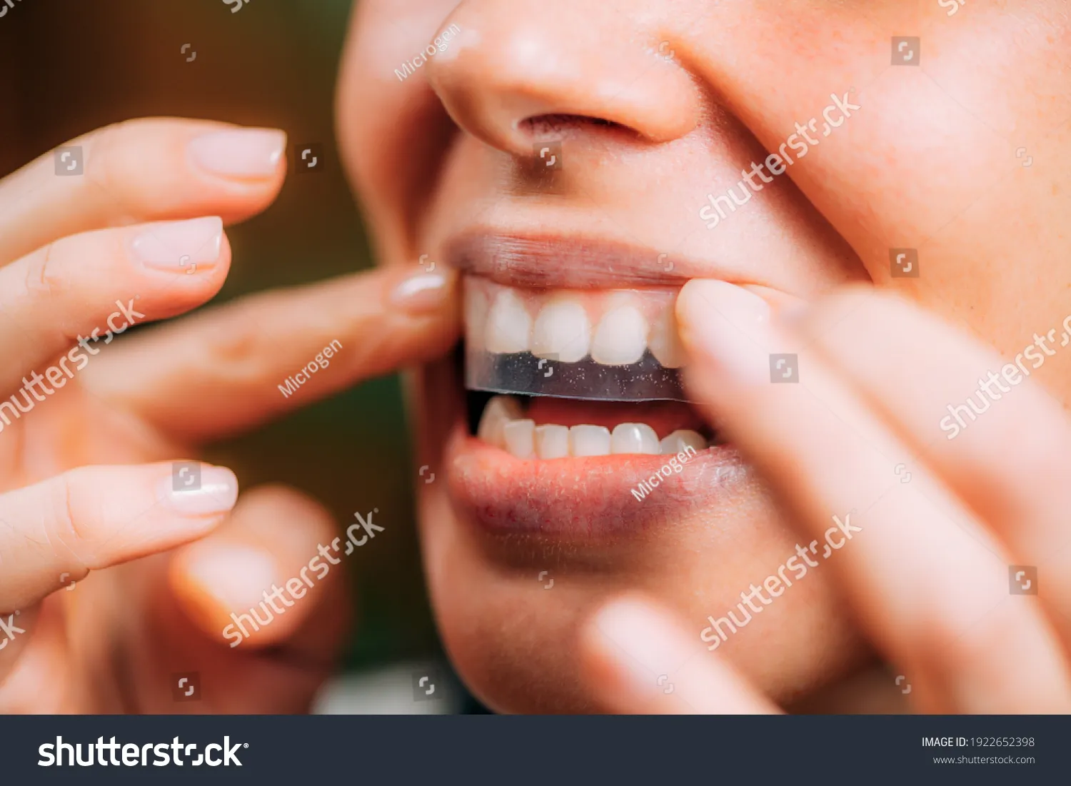 34528 sensitive teeth whitening