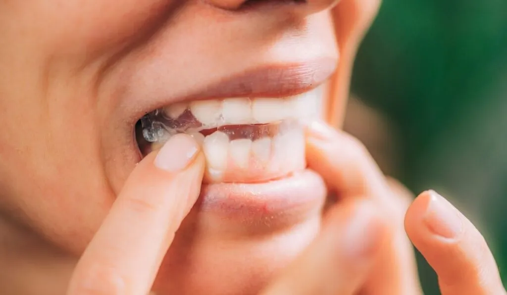 34528 teeth whitening strip mistakes