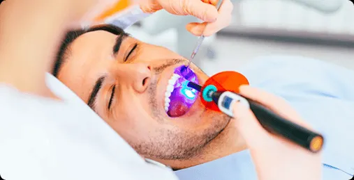 34534 in office teeth whitening