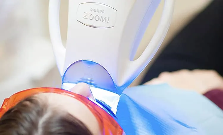 /img/34534-smiling-after-teeth-whitening.webp