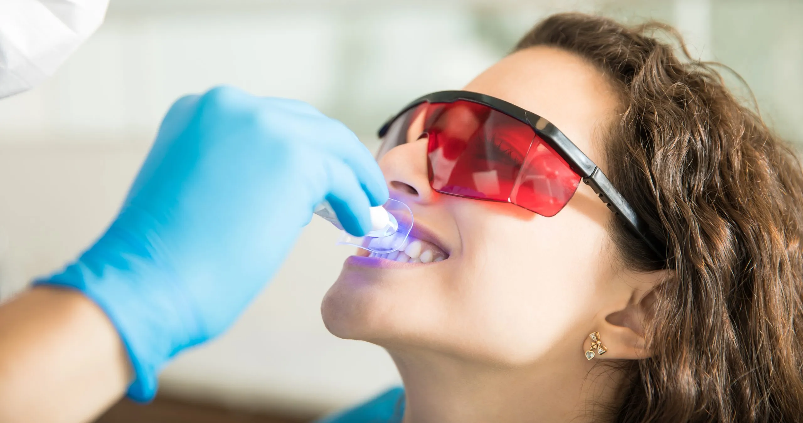 34534 teeth whitening before after