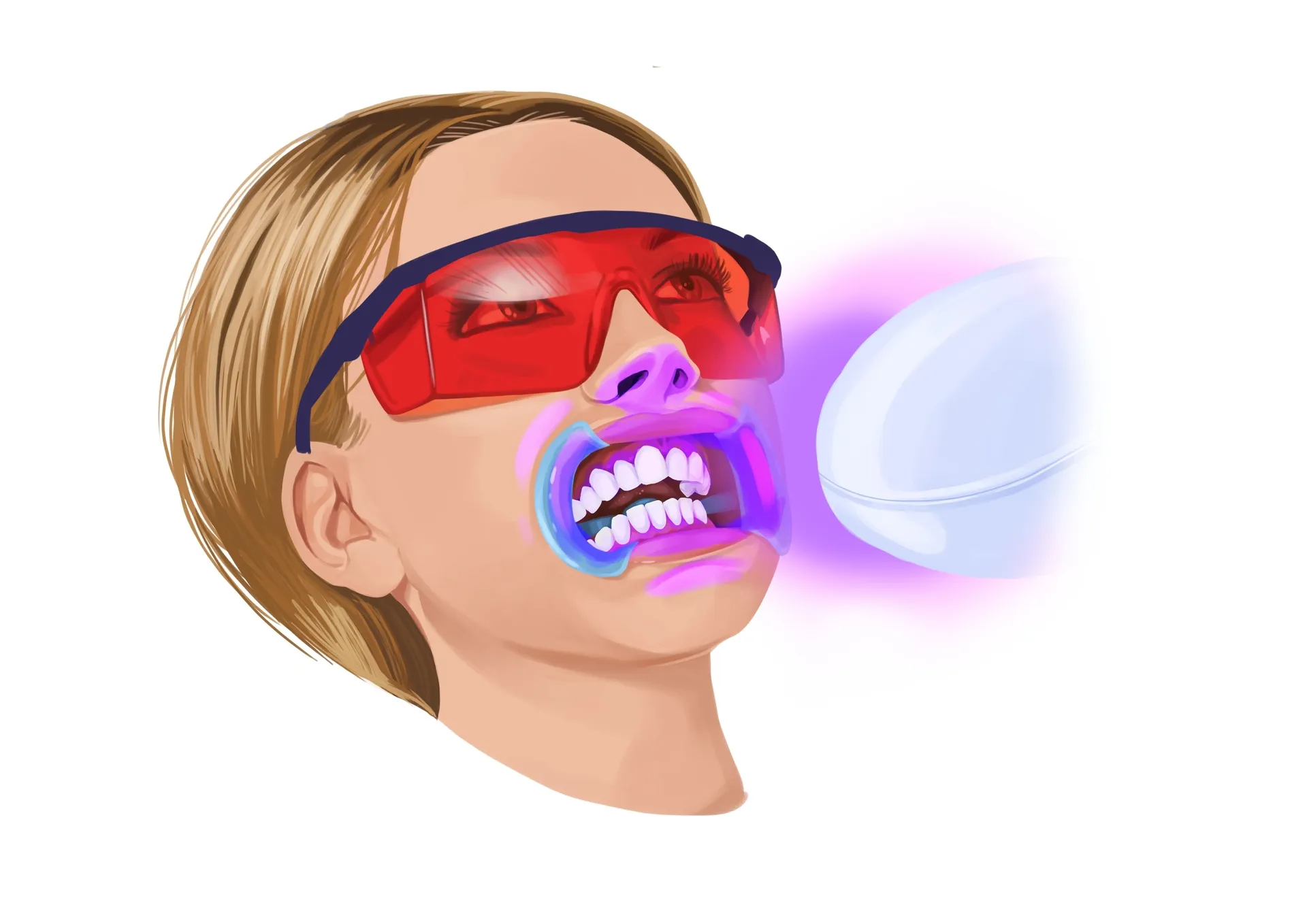 34556 teeth whitening results