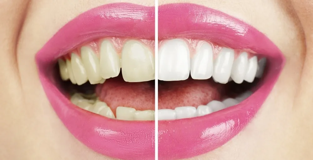 34561 regular dental checkup