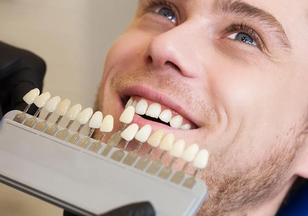 /img/34561-smiling-white-teeth.webp