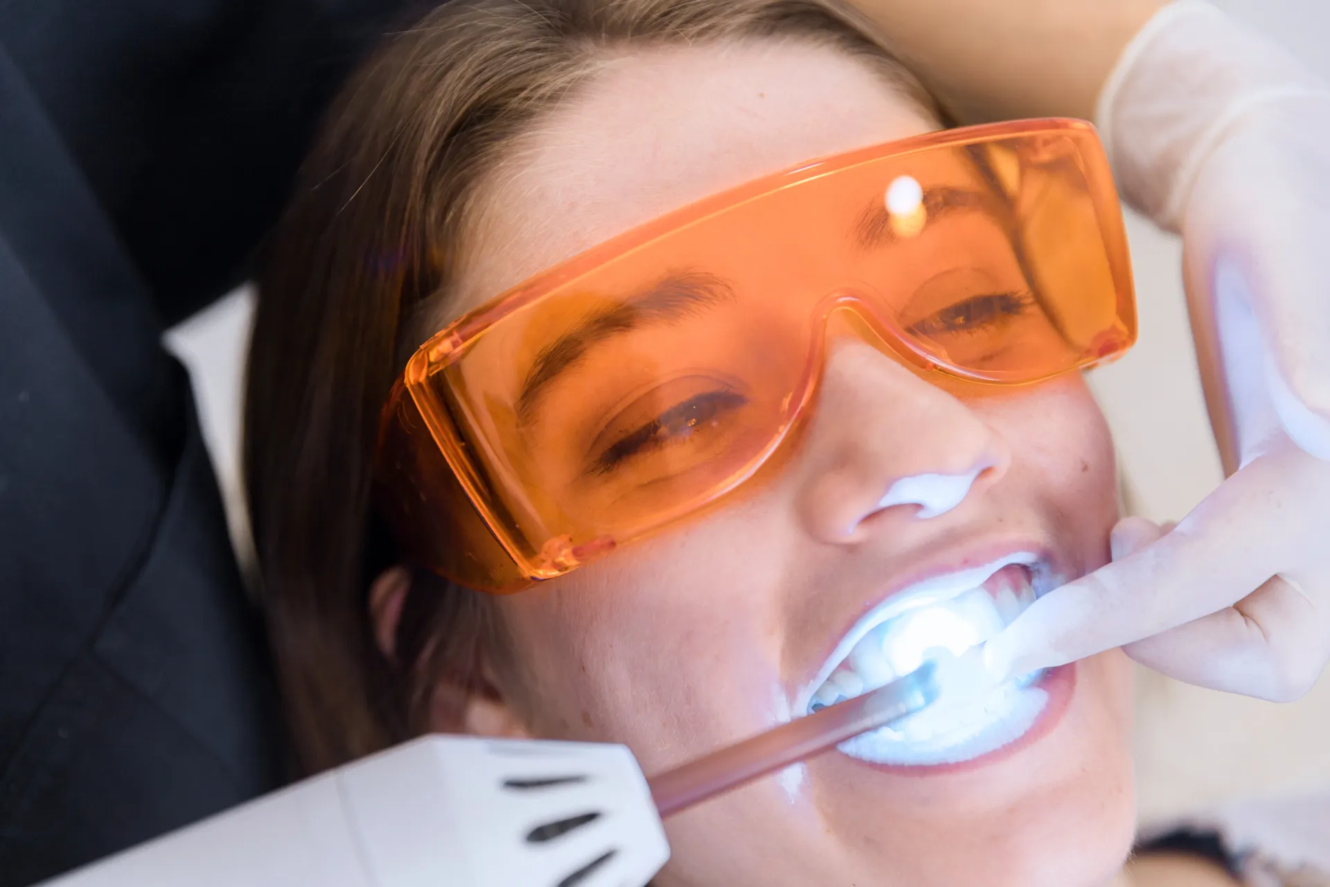 34561 tooth discoloration causes